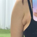 (유)응급환자이송일이구 | 부유방 제거 수술 후기_01 [2년간의 기록/ㄷㅅㅇ]