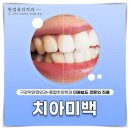 한걸음더치과의원 이미지