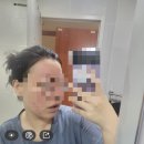 울산데자뷰메디스킨(쪽팔림리얼사진후기)