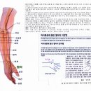 발작예감이 들때 휴대용 수지침을 합곡에 꽂아 이미지