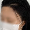 헤드샷스칼프SMP부산 | [성남시 분당구/분당SMP] 헤어라인두피문신 자연스럽게 잘 하는 곳, '헤드샷스칼프 분당본점'