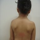 SNPE척추운동 이미지