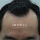 모먼트의원