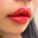 오랜지디자인 | 운정입술 이결 자연스러운 립틴트 디자인 솔직후기