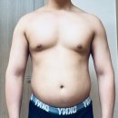 리디안의원 | 리디안의원 복부지방흡입 후기