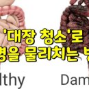 대장 청소’로 만병을 물리치는 방법 ​ 이미지