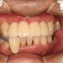 커스텀기공소 이미지