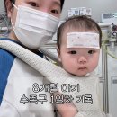 화성프라자약국 | 8개월 아기 수족구 증상, 1일차 기록 | 고열·입안 물집 시작