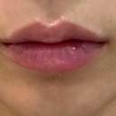 롤리팝성형외과의원 이미지