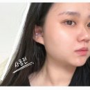 (주)메디스타 | RC리커버리셀크림 레이저로 지친 피부에게 재생크림 추천 후기