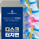 미아연세튼튼마취통증의학과의원 | 허리디스크 터지면 통증 강도, 부위