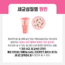 구월우리약국 | 초록색 노란색 연두색 냉 증상따라 여성질염종류 달라요 [구월 로앤산부인과 여의사 진료 후기]