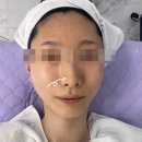 당산 피부관리 마고스킨, 수부지 케어 후기, 본격 간증글(진짜 피부 광명찾음요 )