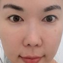 남피부과의원 | 청담동 피부과 유목민 아란의원 정착한 이유 (feat. 셀르디엠 3주차 솔직후기)