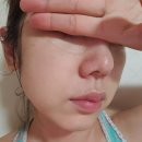 엔도플러스 이미지