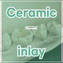 온치과기공소 이미지