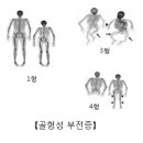 골형성 부전증 (Osteogenesis imperfecta) 유전질환이란? 이미지