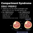 올케어핏 이미지