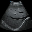 엔도소노 이미지