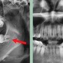 CW-2095-01 이미지