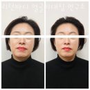 당당한 체형 연구소 | 대연동도수치료 리턴바디 얼굴비대칭 연구소 추천