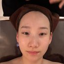 잠원 신사역 피부관리 레브영 에스테틱 웨딩케어 후기
