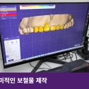 청도치과기공소 이미지