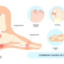 다빈치엑스티 이미지