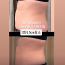 빅토리헬스 | 마운자로,지속성이 힘든 운동안녕🖐 쉽고 건강한 다이어트 선택‼️이뮨팩토리 빅토리점 방문한 이유🥰