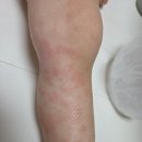 미곡 | [쌀도넛, 쌀빵] 36개월 원인불명두드러기 아기 빵 대체식품 미곡상회 후기.