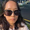 바바성형외과의원 | [일상] 인상이 확 달라 보이는 쌍꺼풀 수술 후기~★ (ft. 바바 성형외과의원 하단점)