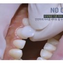 미라클치과기공소 네이버블로그