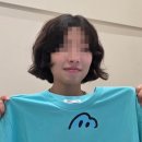 예스피부과의원 | [선릉역피부과] &#34;마이미의원&#34; 쥬베룩볼륨 팔자/땅콩형 얼굴 1회차 후기