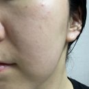 물광 미스트 추천 리쥬베닐 아바파하 샴페인 미스트앰플 후기