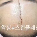 미네일앤스킨 이미지