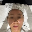 우즈메디컬케어 | [비오엘 서면본점] 서면 피부관리 추천｜1회만으로도 변화를 느끼는 밸런스 관리 후기