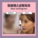 탑성형외과의원 이미지