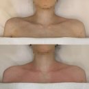 (주)포크랭 하남미사점 | 하남미사 웨딩관리 꼬미에스테틱 드레스핏 살리는 신부관리 후기