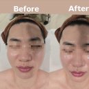 은월초교 | 울산 북구 에스테틱 웨이브온다 뷰티호텔286 내돈내산 솔직후기