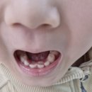 꾸러기치과의원 네이버블로그