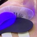 논현맑은의원 | 강남/논현역 속눈썹연장샵 5회차 방문: 애니메래쉬 LED 1세대♠