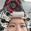 멍묭실 | [광고X] 직장인 쌍커풀수술 브이로그 내돈내산 후기(자연유착+윗트임) 4편 (4~7일차)