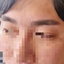 브로우즈맨