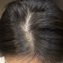 헤어온의원 이미지