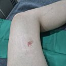 더미소피부과의원 네이버블로그