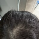 (주)동양의료기기 이미지