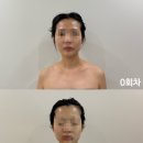 일송노블레스 | 주엽 제이스킨랩 신부관리 내돈내산 후기