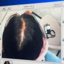 닥터모락(부천상동점) | [부천 닥터모락] 상동 두피케어 여성탈모 관리 후기