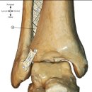 Foot and Ankle Disorders - x ray 영상 진단 이미지