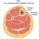 전경골근(tibialis anterior muscle) ; 월간 클리어 2007년 7월호" 연재 (連載)글 이미지